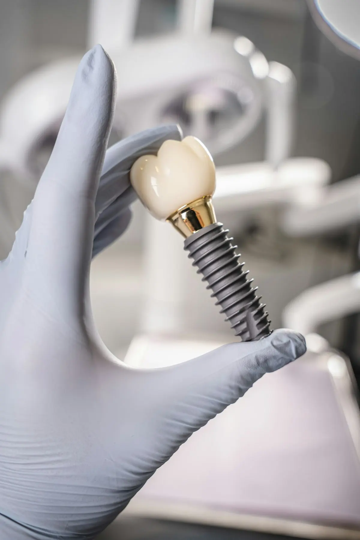 Implante dentário